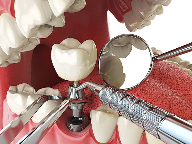 Best Emergency Treatment for Toothache in Blowing Rock, NC